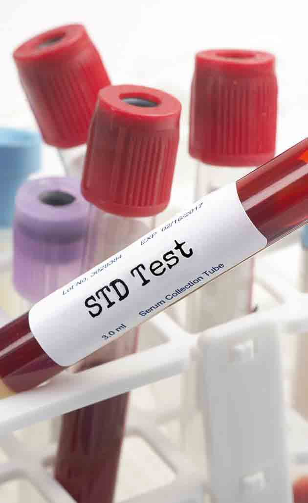 STD Testing Near Me in  Mineola, Melville, and Jericho, NY